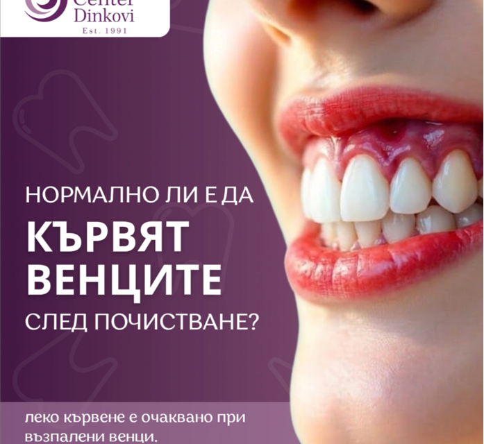 Кървене на венците след почистване на зъбен камък: нормално ли е?