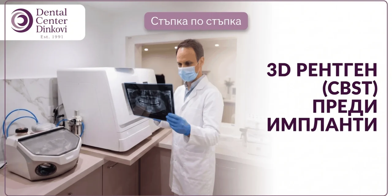 3D рентген (CBCT) преди импланти: Кога е необходим и цена във Варна